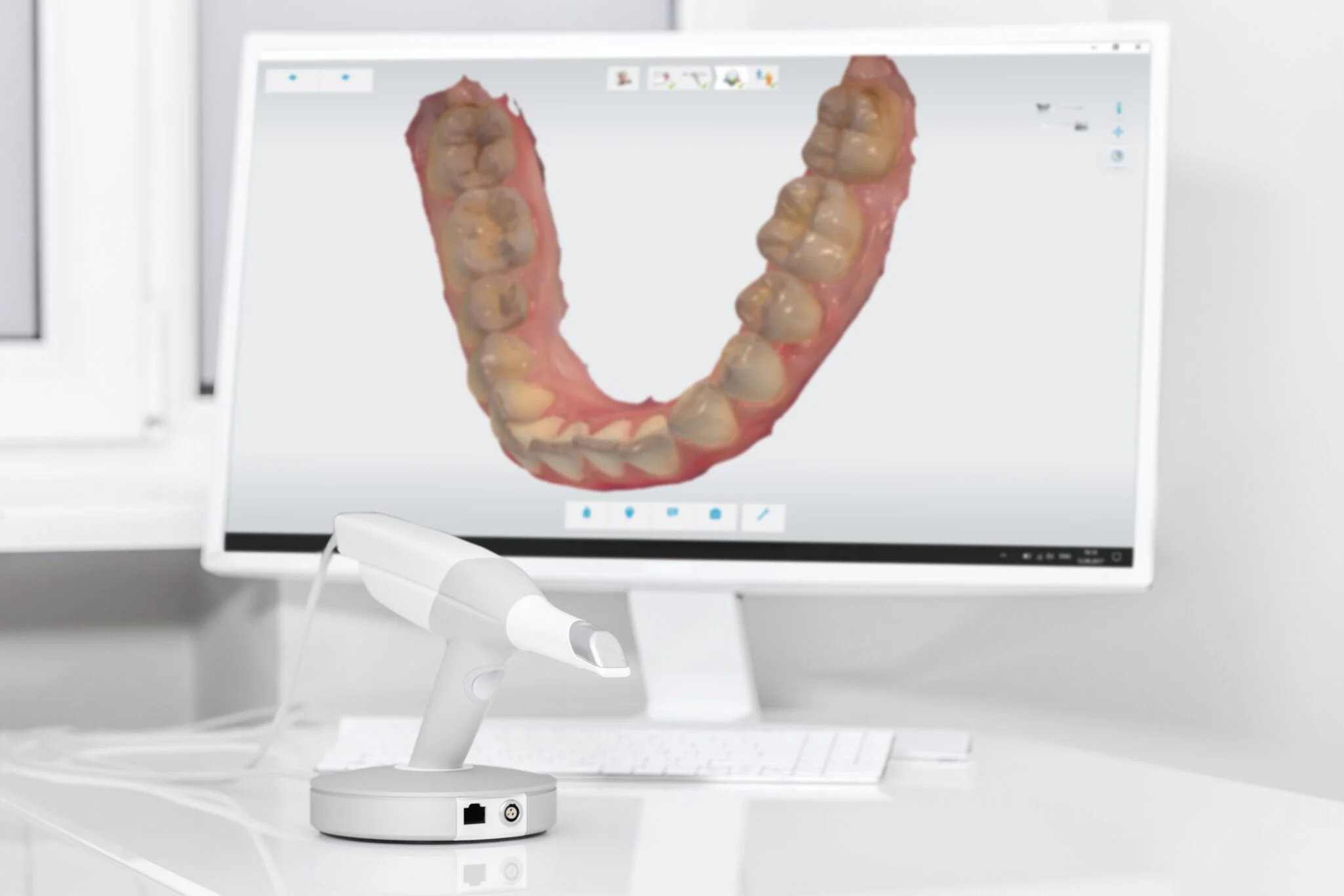 State-of-the-art dental technology at MDRN Dental Studio McKinney