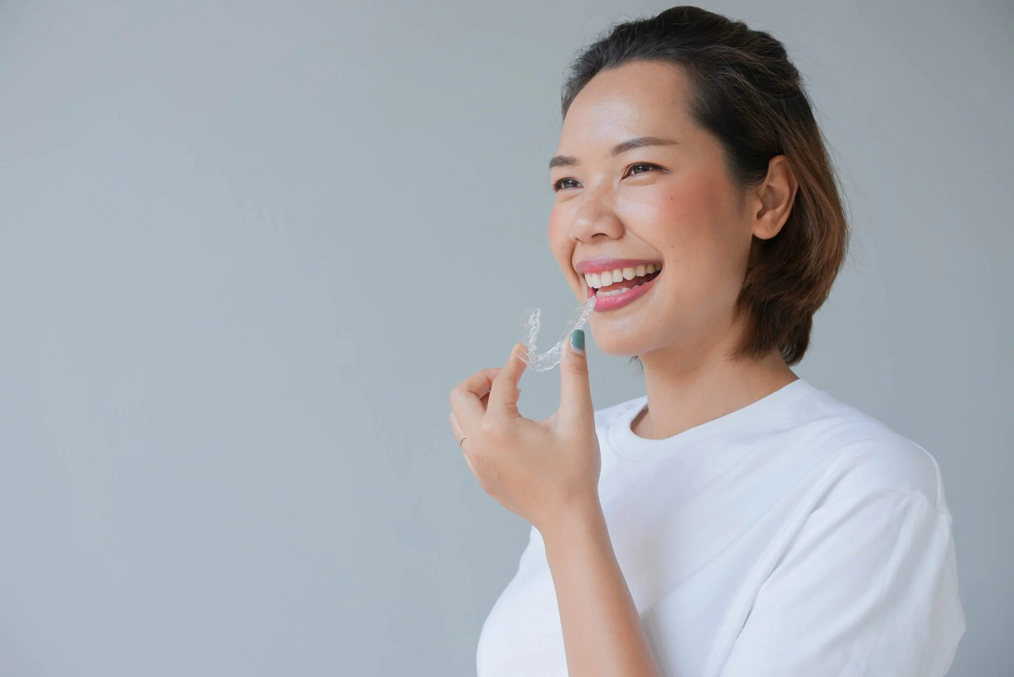 Clear Aligners at MDRN Dental Studio